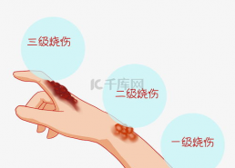 胳膊烫伤图片,从图片看胳膊烫伤处理方法